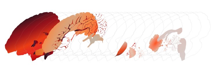 exploded_brain2-30Aug17