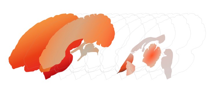 simple_exploded_brain-31Aug17