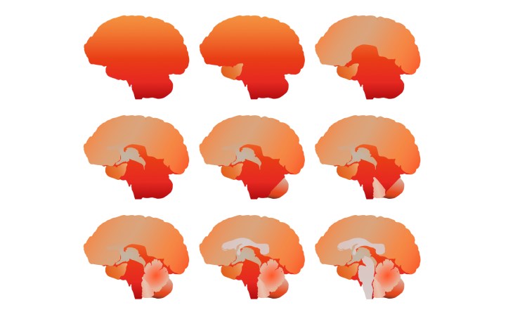simple_sequential_brain-31Aug17